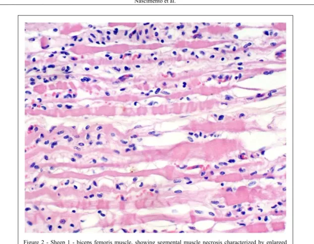 Figure 2 - Sheep 1 - biceps femoris muscle, showing segmental muscle necrosis characterized by enlarged  eosinophilic  fibers,  with  loss  of  cross  striation,  nuclear  pyknosis  and  a  few  fragmented  and  deteriorated fibers