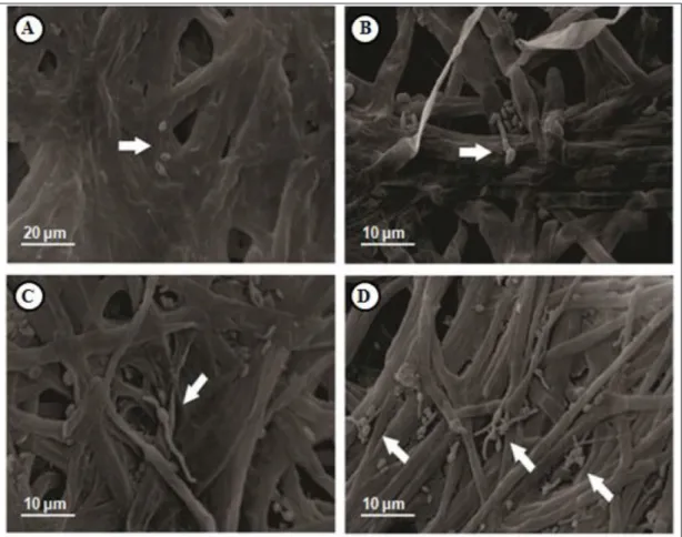 Figure 1 - Scanning electron micrographs of A. bisporus inoculated with L. fungicola. Sample collect times after inoculation