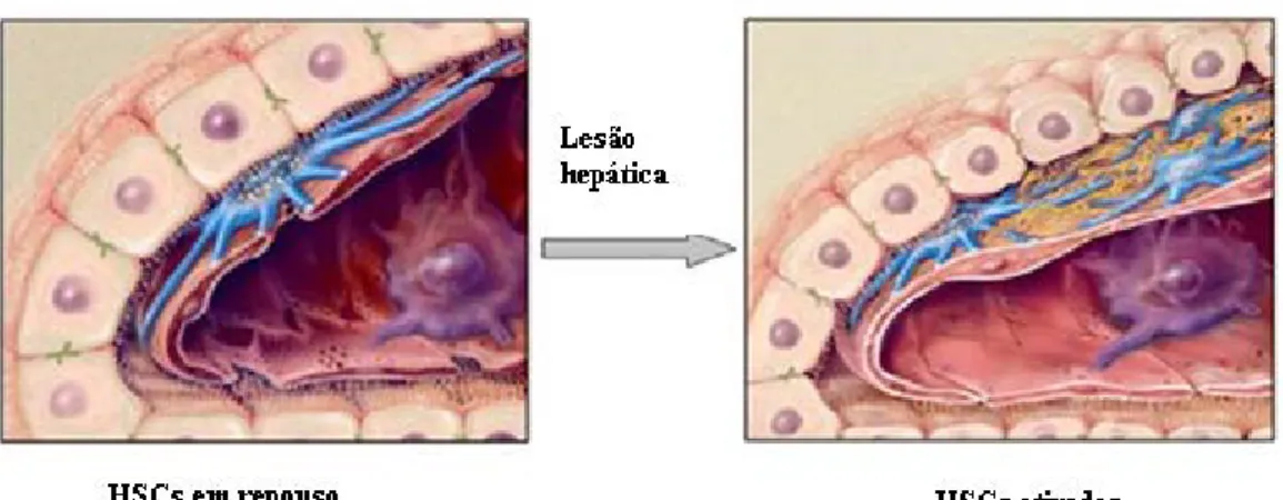 Figura 11 – Ativação das células estreladas hepáticas (Adaptado de Mann e Mann, 2009)