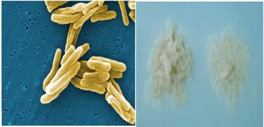 Figura 5 – Mycobacterium tuberculosis observada em microscopia eletrónica (imagem  da esquerda), colónias de Mycobacterium tuberculosis no meio de cultura  Lowenstein-Jensen (imagem da direita) Adaptado (CDC, 2013b)