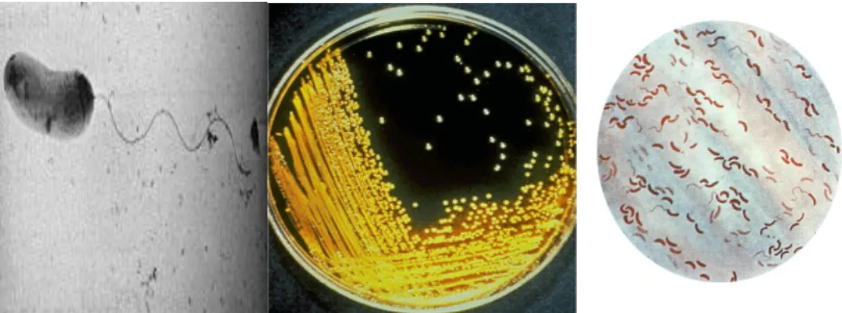 Figura  13-  Vibrio  cholerae  visualizada  ao  microscópio  eletrónico  Adaptado  (Bacteriology,  2012),  Meio  TCBS  inoculado  com  V.cholerae  Adaptado  (CDC,  2015),  V