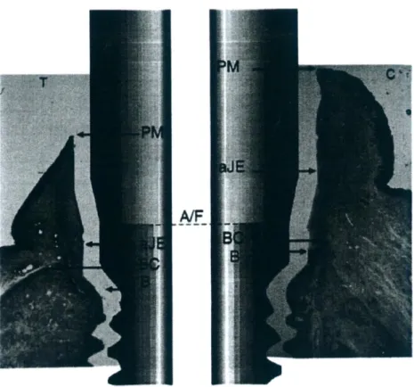 Fig. 5: Microphotograph of one test (T) and one control (C) site. Note in the test side, the presence of an  angular bone defect