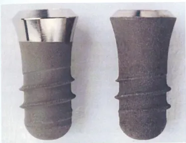 Fig. 10: Implant with a relatively smooth machined titanium collar (left). The rough surface of both  implants is a sand-blasted, large-grit, and HC1/H2S04 dual acid-etched (SLA) surface (Alomrani et 