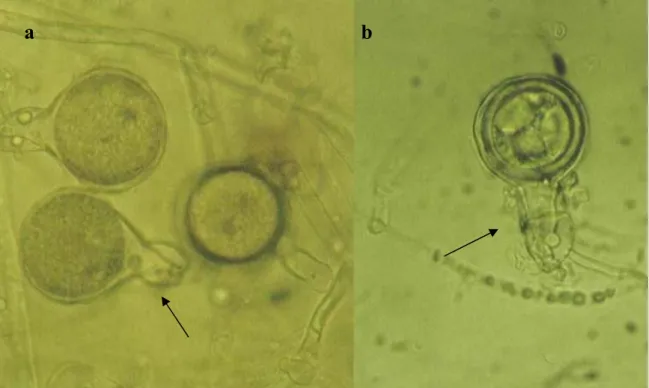 Figura 11 – Formação dos oósporos em Phytophthora cinnamomi – a) – Anterídios unicelulares, b) –  Anterídios bicelulares