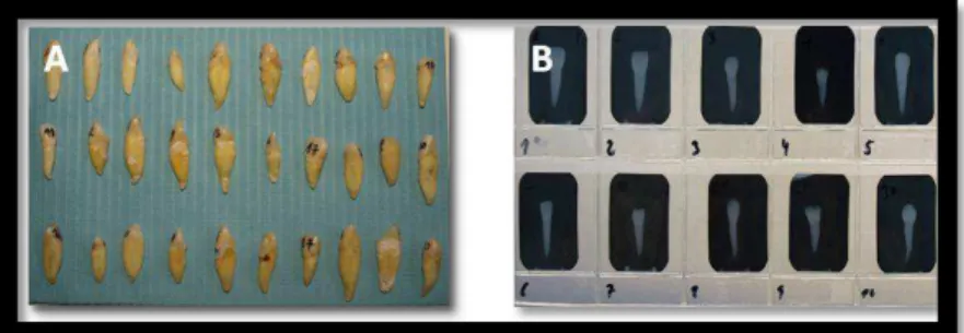 Fig. 3 – (A) Fotografia da amostra (30 dentes monorradiculares) utilizada no estudo. (B) Fotografia dos  Rx iniciais da amostra nº1à nº10