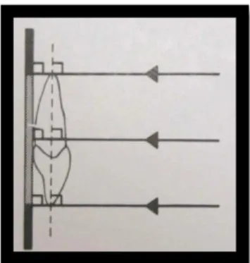 Fig. 7  – Técnica do paralelismo. Ilustra-se o paralelismo entre o maior eixo dos dentes e a película