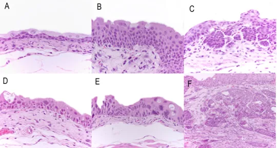Figure  3:  Histopathological  evaluation  of  lesions  identified  in  mouse  urothelial  carcinogenesis  induced  by  BBN