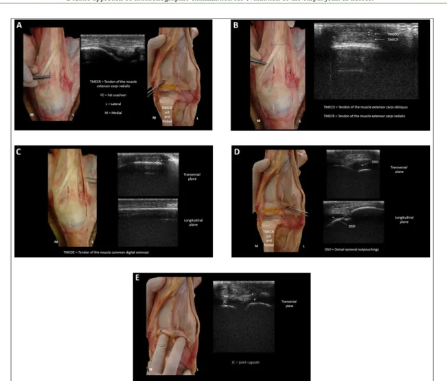 Figure 1 (A, B, C, D, E) - Dorsal carpus: TMECR = tendon of the muscle extensor carpi radialis, FC = fat cushion, TMECO 