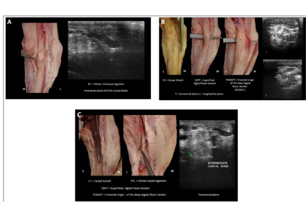 Figure 4 (A, B, C) - Palmar carpus: PIL = palmar intercarpal ligament, CS = carpal sheath, SDFT = superficial digital flexor  tendon, PODDFT = proximal origin of the deep digital flexor tendon, CT = carpal tunel, PCL = palmar  carpal ligament, intermediate