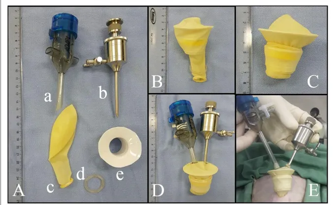 Figure 1 -  Assembly of the homemade multiport access device for LESS ovariohysterectomy in queens