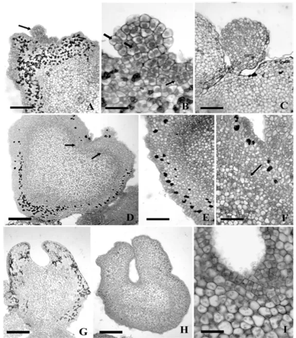 FIGURE 2:  Developmental stages of somatic embryos of Ocotea porosa. A) Longitudinal section of the  pro-embryo (eg arrow), bar: 150 µm