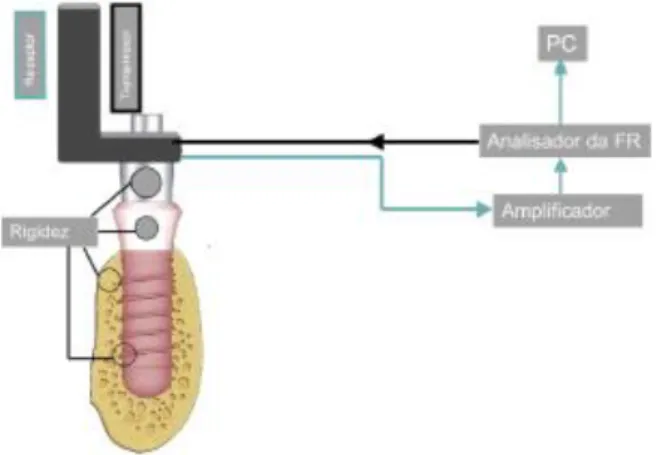 Figura 10- Sistema de Frequência de Ressonância Osstell ®  Transducer (Nicolau, 2007)