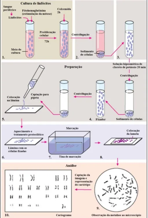 Figura  1.13  –  Principais  etapas  envolvidas  na  obtenção  de  um  cariograma  a  partir  de  amostras  de  sangue  periférico: cultura de linfócitos (1), colheita dos cromossomas em metafase (2), preparação dos cromossomas  (3-5), bandagem (6-8), anál