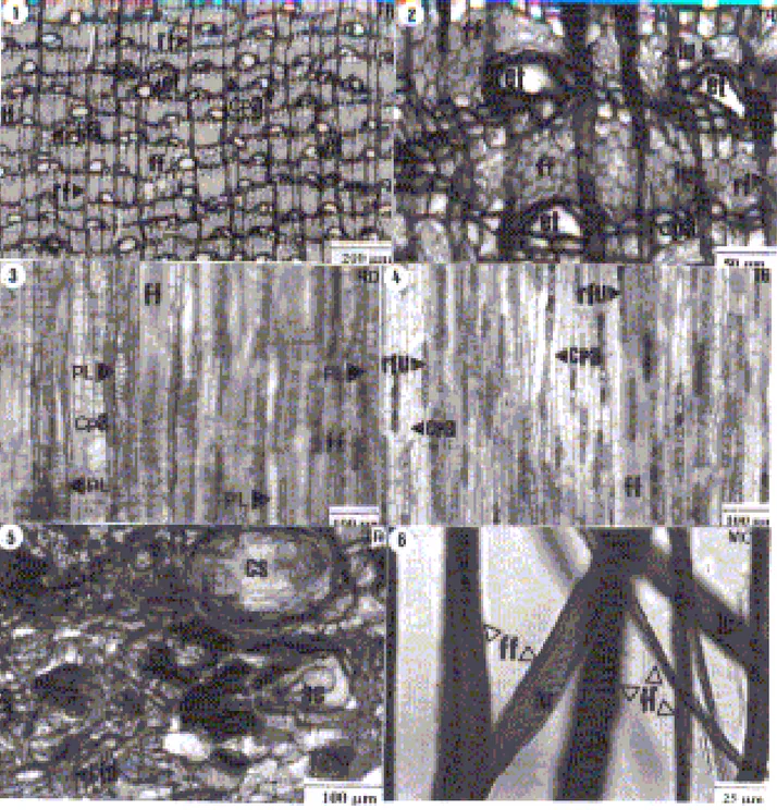 FIGURA 2:   Fotomicrografias da casca de Eucalyptus smithii R.T. Baker. Fibras floemáticas (ff); lume (lu);