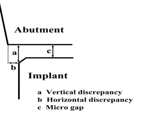 Figura 3: Discrepância implante-pilar. (Ref. Tsuge et al., 2008). 