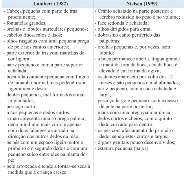 Tabela I: Características das crianças com Trissomia 21 (adaptada de Sampedro,  Blasco &amp; Hernández,1997:227; Nielsen, 1999:121-122)