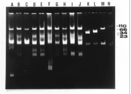 FIG. 2. Agarose gel electrophoresis of Acinetobacter baumannii plasmid DNA extracted by the method of Kado &amp; Liu (1981)