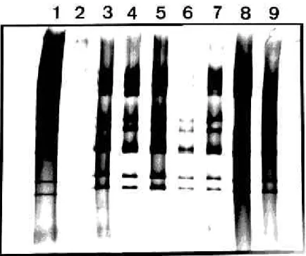 Figure 1 - Polyacrylamide gel electrophoresis of  rotavirus strains RNA detected in human feces