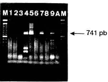 Figure 2 - Reverse Transcriptase-Polymerase Chain Reaction for G typing (VP7) of human rotavirus strains detected in feces (Gouvea et al., 1990)