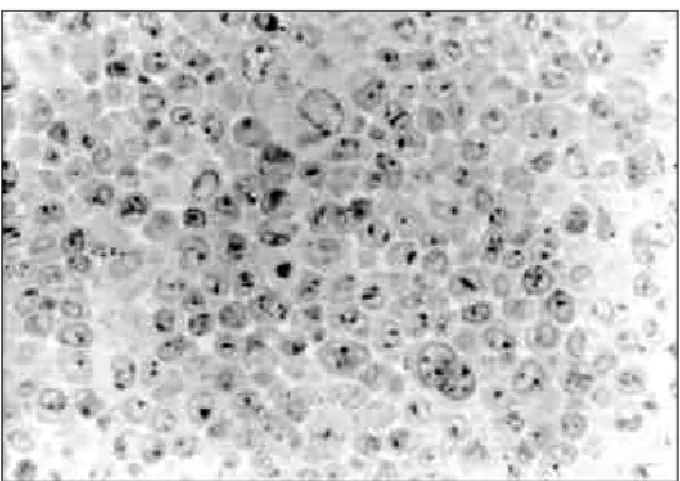Figure 1 - Photo showing the capture of GL protein by BHK cells after 5 minutes of incubation (400x).