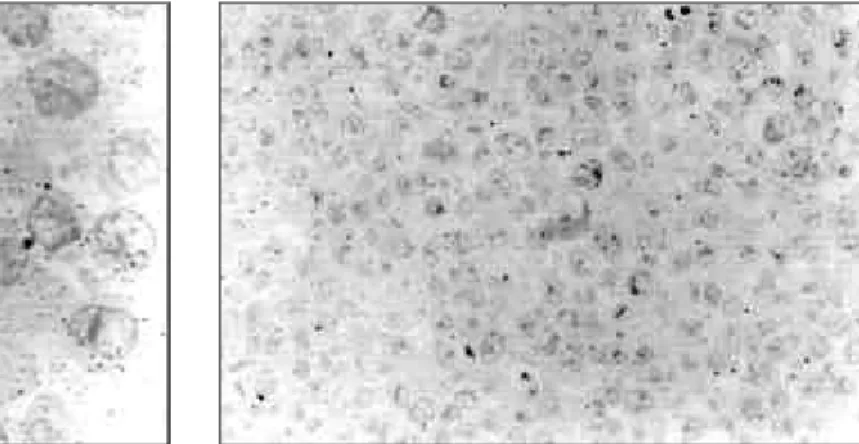 Figure 2 - Light chain immunolabelling after 24 hours incubation with GL protein (1000x).