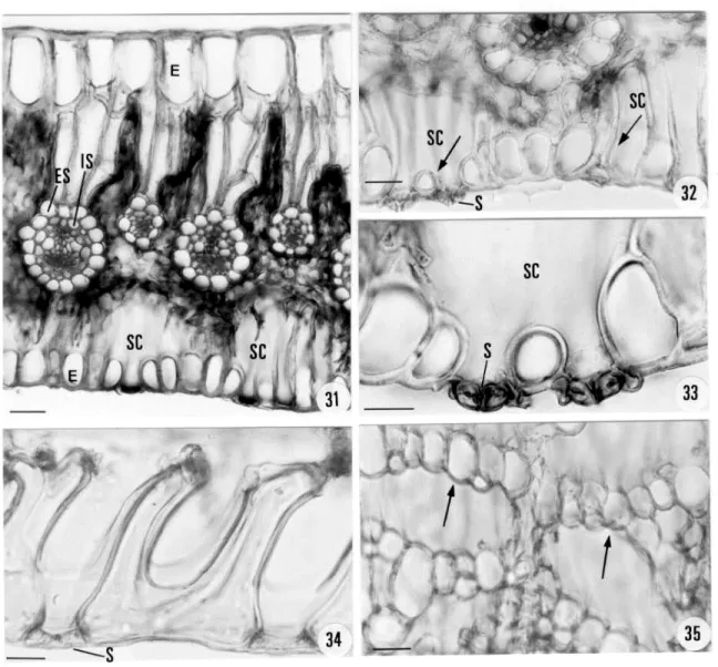 Fig. 31 scale = 60µm. Fig. 32 scale = 30µm. Fig. 33 scale = 20µm. Longitudinal (Fig. 34) and paradermical (Fig