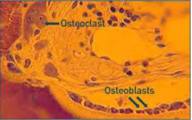 Figura 2:  Osteoclastos e osteoblastos em um osso normal (azul de toluidina, X100). Fonte: 