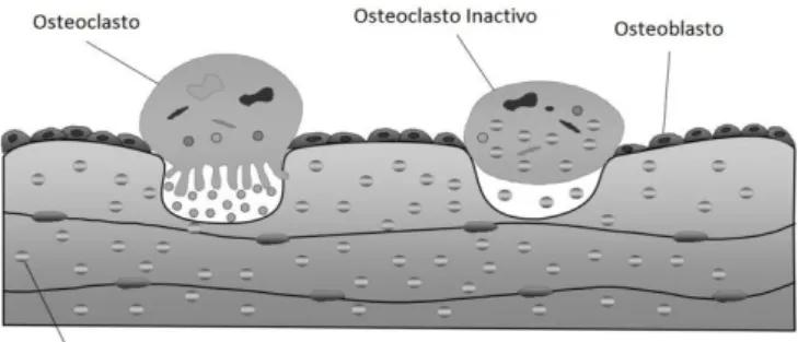 Figura  3-  Morfologia  do  osteoclasto  activo  e  inactivo.  (Adaptado:Shanbhag  A.,  (2006)  Use  of  Bisphosphonates  to  Improve  the  Durability  of  Total  Joint  Replacements