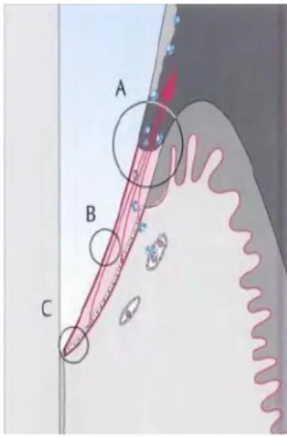 Figure 2: A bottom of the sulcus, B:epithelial attachment, C:apical limit of epithelial  attachment, Font (Wolf et al 2005) 