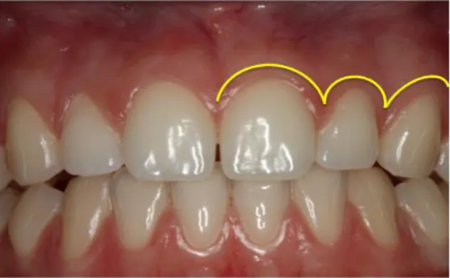 Figura 3- Aspeto morfológico do contorno e forma da gengiva.    