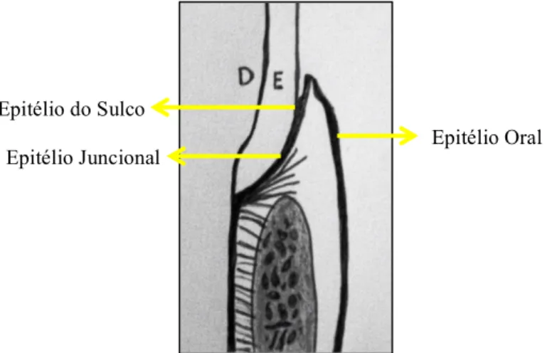 Figura 11- Representação esquemática do Epitélio oral ou bucal, Epitélio do sulco e Epitélio juncional