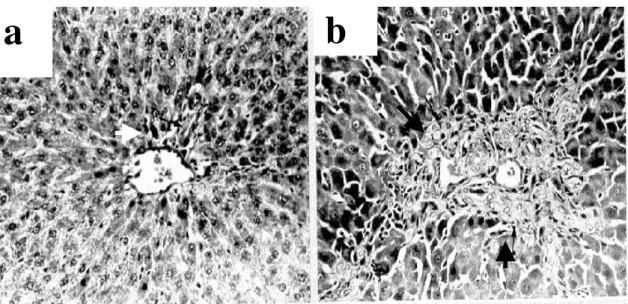 Figure 3 - Histological  analysis  of rat livers. (a) sham animal, simulated  surgery, presenting a lobular architecture and a  periportal space  without histological alterations;