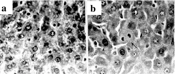 Figure 4 - Histological aspects of the rat livers. (a) sham animal, simulated surgery, presenting hepatocytes with nuclei of relatively uniform dimensions; (b) CBD animal seven days after ligature of the common bile duct, presenting hepatocytes with polypl