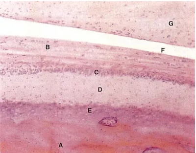 Figura 2  –  Corte sagital do côndilo e disco articular. Osso subcondral (A), superfície articular fibrosa (B), zona rica  em células (C), camada fibrocartilaginosa (D), zona de cartilagem calcificada (E), espaço articular inferior (F) e disco 