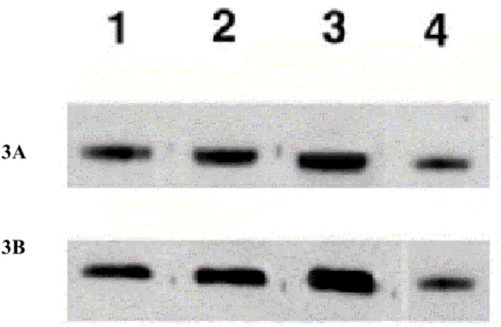 Figure 3 - Northern blot analysis of sucrase genes transcripts 