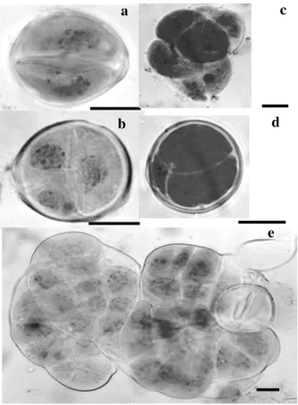 Figure 4 - Symmetrical and multicellular soybean pollen grains. a- symmetrical pollen grain; b,  c and e- multicellular pollen grain; d- multicellular pollen grain with two vegetative  and one generative cell