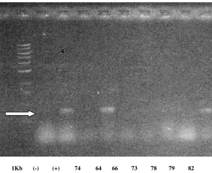 Figure 1 - PCR amplification with primers  ANY-SSD/F of the cphA gene  1 Kb: Ladder; 74: A
