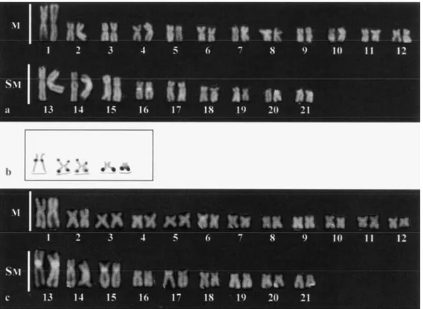 Figure  3  -  Chromomycin  A 3   stained  karyotypes  (a,c)  of  Hoplias  malabaricus  from  the  eastern  and  western  populations,  respectively,  showing  the  GC-rich  chromosome  segments