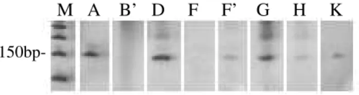Figure 3 - Electrophoresis in 0.8% agarose gel of extracted DNA samples. Letters correspond to  the protocols F, F’, G, H, I and J