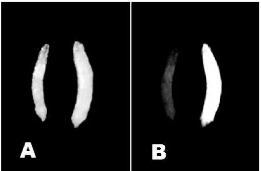 Figure 2 - Pattern of 3xP3-EGFP gene expression in D. willistoni transgenic larvae. (A) Control  (left)  and  transformed  (right)  larva