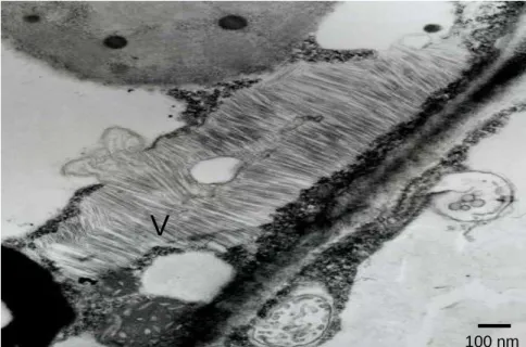 Figure 1 - Transmission electron micrograph of ultratin sections of Lycopersicum esculentum 
