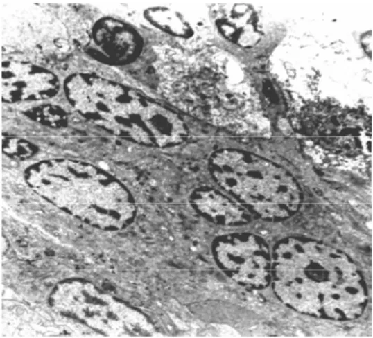 Figure 6 - Ultraestructural photomicrography of Arius sp. muscle tissue. No cytoplasmic  membrane enveloping each nucleus