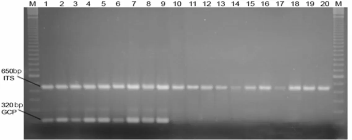 Figure 3 - Agarose gel electrophoresis of PCR using the primer pairs GCP1/GCP2 and ITS1/ITS4,  and isolates of G