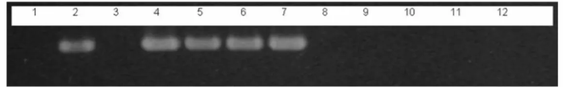 Figure 4 - Agarose gel electrophoresis of PCR using the primer pair GCP1/GCP2 and isolates of  G