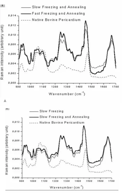 Fig.  5  compared  the  effect  of  thermal  treatment  (annealing)  on  the  bovine  tissue  secondary  structure