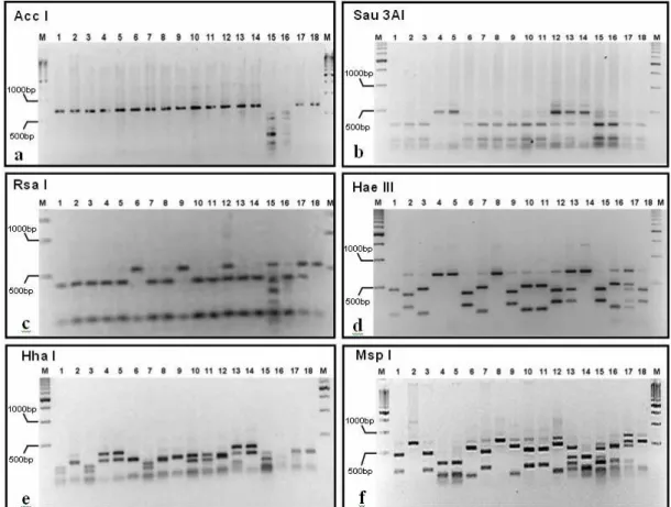 Figure 2 - Restriction digest of the cpcBA-IGS PCR products of Microcystis spp. electrophoresed  on a 1.5% agarose and stained with ethidium bromide