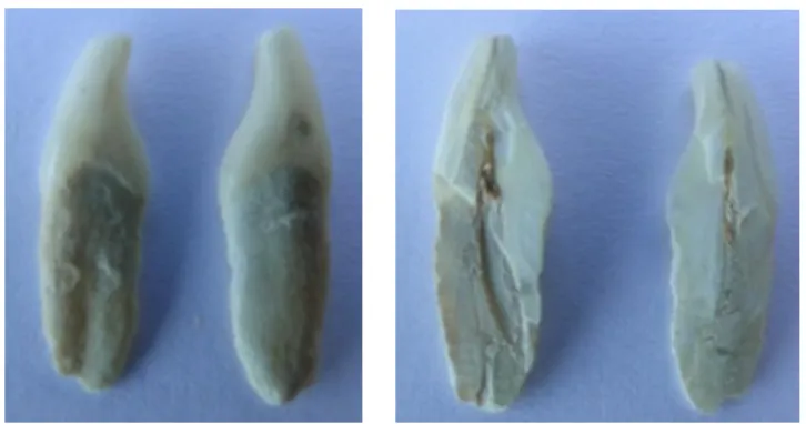 Figura 4  –  Exemplar seccionado no sentido vestíbulo-lingual ao longo do eixo  longitudinal do dente 