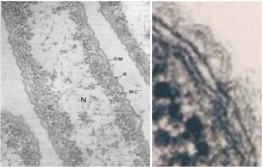 Figura 11.  Célula de  E.coli (ME). OM-membrana externa; N-nucleóide; R-camada  rígida; MC-membrana citoplasmática
