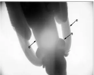 Figure 1. Nectaries (n) located between the short stamen (e) and the ovary (o); (increased of  four fold).