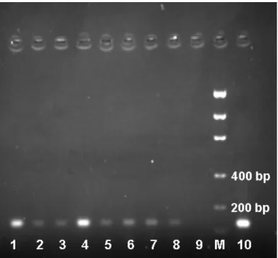 Figure  1  -  Amplified  fragment  of  the  BDR  region  of  the  mtDNA  Cytochrome-b  gene  obtained  from  dentin  powder  of  preserved  teeth:  (1-3,  5-8)  dentin  of T